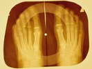 Elvis Presley - As Long As I Havе Yоu X-RAY OF USSR X-RAY BONES RECORDING