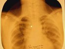 Jimi Hendrix - Foxey Lady  X-RAY OF USSR X-RAY BONES RECORDING