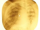 Elvis Presley - Rip It Up  X-RAY OF THE USSR X-RAY BONES RECORDS