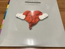 Kanye West - 808s and Heartbreaks 2xLP Vinyl Record Deluxe Collector's Set