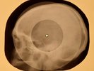 Beatles - Nowhere Man X-RAY OF USSR X-RAY BONES RECORDING SKULL