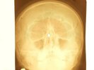 Zombies - This Will Be Our Year X-RAY OF THE USSR X-RAY BONES RECORD