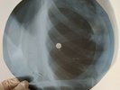 DUSTY SPRINGFIELD HEARTBEAT X-Ray USSR Record Roentgen Bones Ribs Music Vinyl