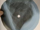 ELVIS GIRL OF MY BEST X-Ray USSR Record Roentgen Bones Ribs Music Vinyl