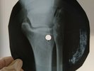 ELVIS BLUE SUEDE SHOES X-Ray USSR Record Roentgen Bones Ribs Music Vinyl