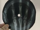 BEATLES THERE IS A PLACE X-Ray USSR Record Roentgen Bones Ribs Music Vinyl