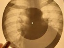 Del Shannon - Runaway X-RAY OF THE USSR X-RAY BONES RECORDING