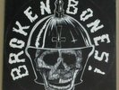 BROKEN BONES - i o u nothing , MLP 1984 D
