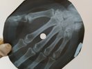 ADAM FAITH TIME HAS COME X-Ray USSR Record Roentgen Bones Ribs Music Vinyl