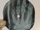 NINA SIMONE HUMAN TOUCH X-Ray USSR Record Roentgen Bones Ribs Music Vinyl