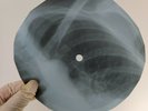 NINA SIMONE ANOTHER SPRING X-Ray USSR Record Roentgen Bones Ribs Music Vinyl
