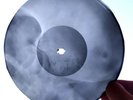 USSR GEORGIAN X-RAY ROENTGEN BONES  RECORD  UNIQUE ITEM 100%  ORIGINAL SKULL