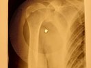 Elvis Presley - That's All Right Mama X-RAY OF USSR X-RAY BONES RECORD