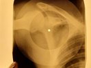 Chuck Berry - Roll Over Beethoven X-RAY OF THE USSR X-RAY BONES RECORDING