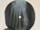 ELVIS PRESLEY RIP IT UP X-Ray USSR Record Roentgen Bones Ribs Music Vinyl