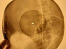 Rolling Stones - Live With Me X-RAY OF USSR X-RAY BONES RECORDING