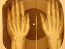 Lots 3 pieces X-RAY OF THE USSR X-RAY BONES RECORDS