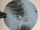BLACK SABBATH IRON MAN X-Ray USSR Record Roentgen Bones Ribs Music Vinyl