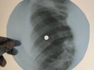 LED ZEPPELIN MOBY DICK X-Ray USSR Record Roentgen Bones Ribs Music Vinyl