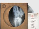 KASABIAN | The Alchemist's Euphoria | X- Ray Picture Disc | Ltd. Edition of 2000