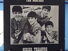 THE BEATLES    'BURIED TREASURE'  2LP