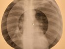 Four Seasons - Cherry Baby X-RAY OF THE USSR X-RAY BONES RECORDS