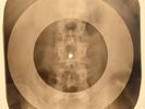 Beach Boys - You Still Believe In X-RAY OF THE USSR X-RAY BONE RECORDS
