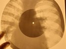 Lots 6 pieces X-RAY OF THE USSR X-RAY BONES RECORDING