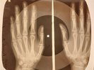 Beatles - Got To Get You Into My Life X-RAY OF USSR X-RAY BONES RECORD