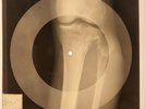 Beatles - Any Time At All X-RAY OF THE USSR X-RAY BONES RECORDING