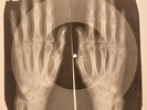 Beatles - Lovely Rita X-RAY OF THE USSR X-RAY BONES RECORD