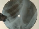 BEE GEES I STARTED A JOKE X-Ray USSR Record Roentgen Bones Ribs Music Vinyl