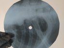OS MUTANTES BABY X-Ray USSR Record Roentgen Bones Ribs Music Vinyl