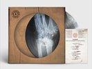 KASABIAN The Alchemist's Euphoria X- Ray Pic Disc Ltd Edition 2000 Rare sold out