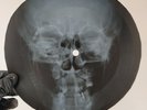 PINK FLOYD ASTRONOMY DOMINO X-Ray USSR Record Roentgen Bones Ribs Music Vinyl