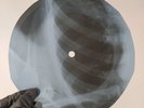 DUSTY SPRINGFIELD HEARTBEAT X-Ray USSR Record Roentgen Bones Ribs Music Vinyl