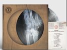Kasabian - The Alchemist's Euphoria (Bones Music Edit) - Picture Disc LP(sealed)