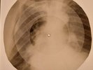 Beatles - Chains X-RAY BONES RECORDS USSR 14