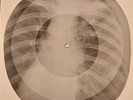 Rolling Stones - Heart of stone X-RAY BONES RECORDS USSR 16
