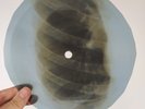 BOB DYLAN TO RAMONA X-Ray USSR Record Roentgen Bones Ribs Music Vinyl
