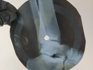 EDDIE COHRAN  SUMMERTIME BLUES X-Ray USSR Record Roentgen Bones Ribs Music Vinyl