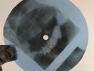 BEATLES ANNA (GO TO HIM) X-Ray USSR Record Roentgen Bones Ribs Music Vinyl