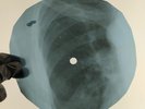 ARMSTRONG WHAT A WONDERFULL X-Ray USSR Record Roentgen Bones Ribs Music Vinyl