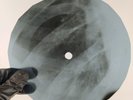 BILL HALEY NEGRA CONSENTIDA X-Ray USSR Record Roentgen Bones Ribs Music Vinyl