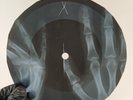 PINK FLOYD IF X-Ray USSR Record Roentgen Bones Ribs Music Vinyl