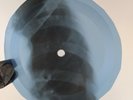 BEATLES HELP X-Ray USSR Record Roentgen Bones Ribs Music Vinyl