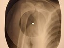 Beatles - Glass Onion X-RAY BONES RECORDS USSR 103
