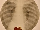 Elvis Presley - Money Honey X-RAY BONES RECORDS USSR 104