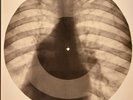 Huey Smith - Pop Eye X-RAY BONES RECORDS USSR 107