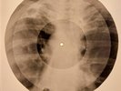Who - Pinball Wizard  X-RAY BONES RECORDS USSR 138